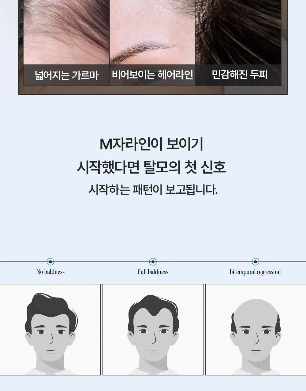 [M자복구앰플/두피괄사] 다슈 데일리 밀크씨슬 스피큘샷 스칼프 앰플 70ml 상세페이지 3